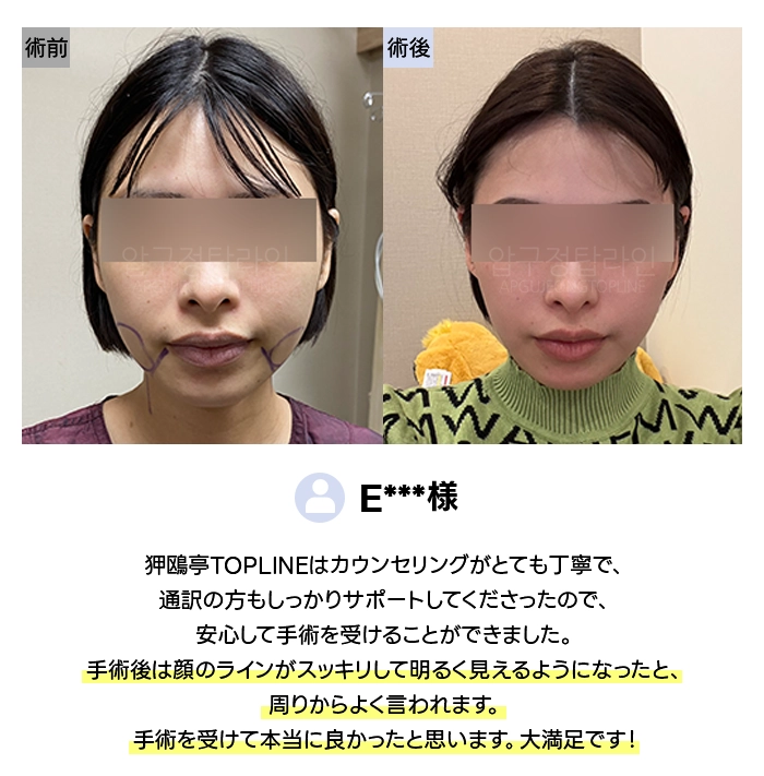 実際の患者様のリアルな声 4