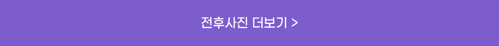 전후사진 더보기